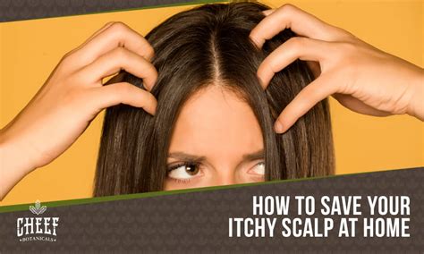 Home Remedies for Itchy Scalp: Stop Scratching Today!