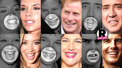 They May Be Beautiful But These Celebs Were Given A Bad Set Of Chompers