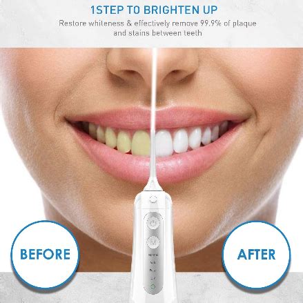 8 Benefits Of Using A Water Flosser That Will Blow Your Mind – B.WEISS Water Flosser