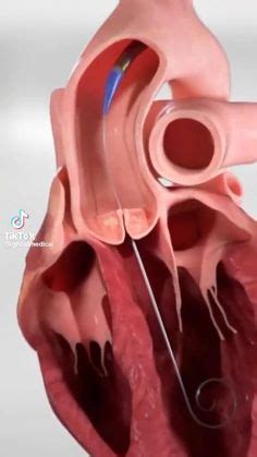 83 Medical animation ideas | medical, animation, medical videos