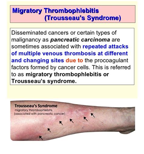 Pin on surgery