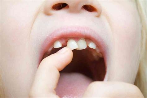 Should I Have My Child’s Baby Teeth Pulled? — Parkview Dental