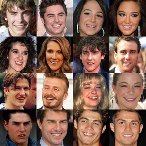 33 Before And After Photos That Prove Good Teeth Can Change Your Entire Face | Teeth braces ...