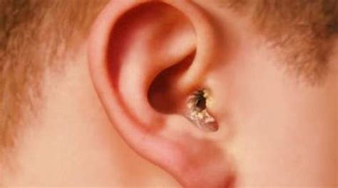 8 Things Your Earwax Could Reveal A Lot About Your Health Status! Here ...