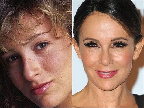 Jennifer Grey Plastic Surgery Before And After Photos | Plastic surgery ...