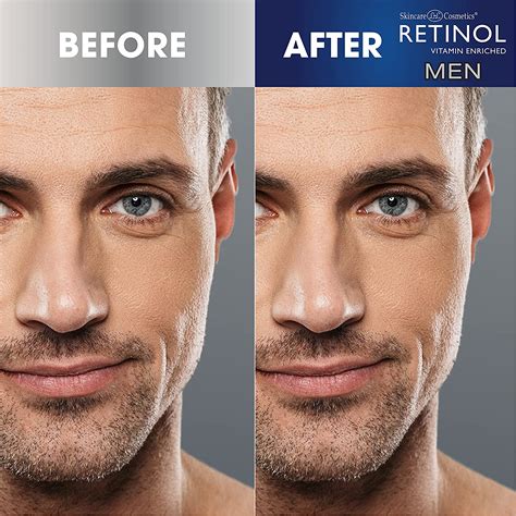 Retinol™ Men's Facial Serum – Fran Wilson