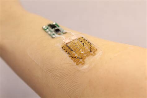 Smart bandages designed to monitor and tailor treatment for chronic wounds