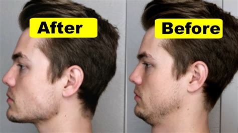 How To Get A Strong Chin And Jawline (Lose Double Chin) - Fat Burning Facts