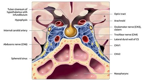 Sella and Pituitary gland imaging Overview