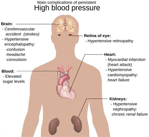 14.6 Cardiovascular Disease – Human Biology