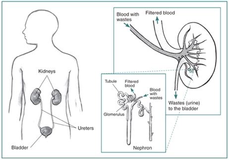 How High Blood Pressure Affects Your Kidneys, Kidney Month