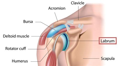 Alternative to Surgery for Shoulder Labrum Tears | Regenexx