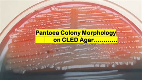 Pantoea colony morphology on CLED agar - YouTube