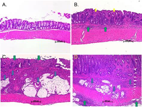 HIF1α deficiency reduces inflammation in a mouse model of proximal colon cancer | Disease Models ...