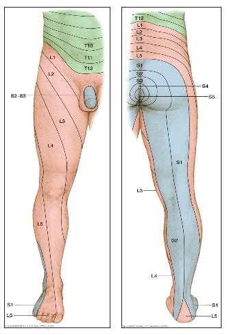 Surgery for Sciatica - a clinical commentary with Dr Lynn Bardin — Rayner & Smale