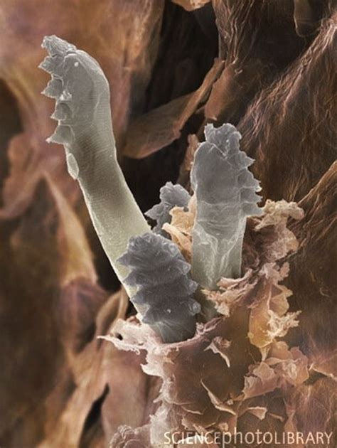 The bad news: Dead mites are spilling their junk onto your face. But this new discovery may lead ...