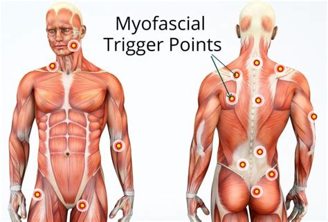 How To Alleviate Muscle Knots - Teachfuture6