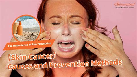 【Skin Cancer】Causes and Prevention Methods | The Importance of Sun Protection - Skincentral ...