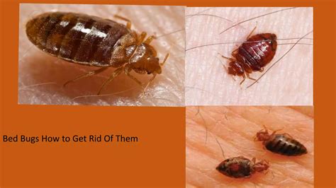 Symptoms of Bedbugs | PPT