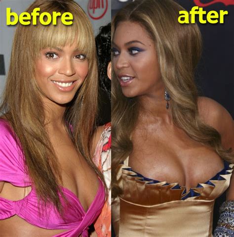 BEYONCE PLASTIC SURGERY Before After Pictures