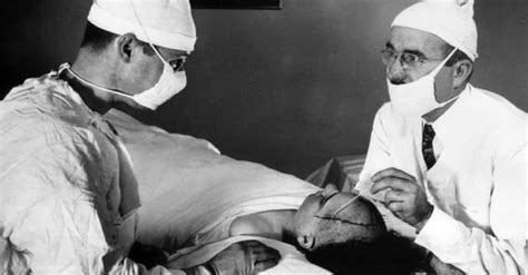 14 Disturbing Facts About The History Of The Lobotomy