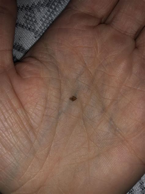 Bed bug shedding? I stayed at a friend’s place that recently got confirmed for bed bugs. : r/Bedbugs