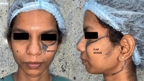 Top plastic surgeon transforms terrible facial injuries into something wonderful - HeadlinePlus ...