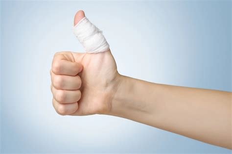 Is My Thumb Broken or Sprained? | Complete Care