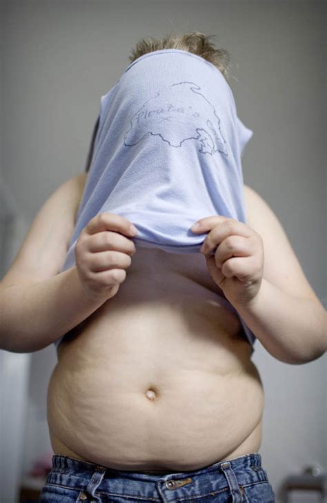 Half of children in poor areas likely to be overweight or obese | Express.co.uk