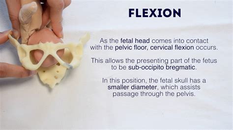 Mechanism of Labour - OSCE Guide | Geeky Medics