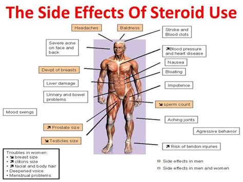 Stay Natural, Say No To Steroids Says Anand Arnold - IBB - Indian Bodybuilding