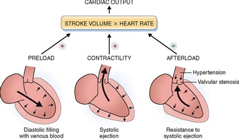 [DIAGRAM] Diagram Of Cardiac Output - MYDIAGRAM.ONLINE