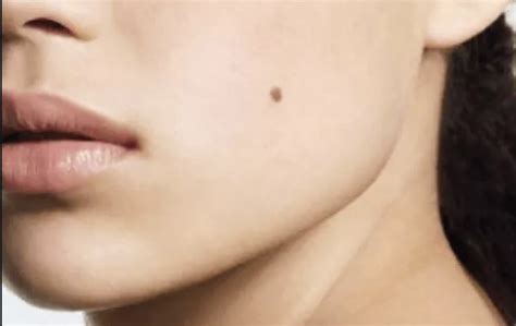 These Are The Secret Meaning Of The Moles in Each Area Of Your Face And ...