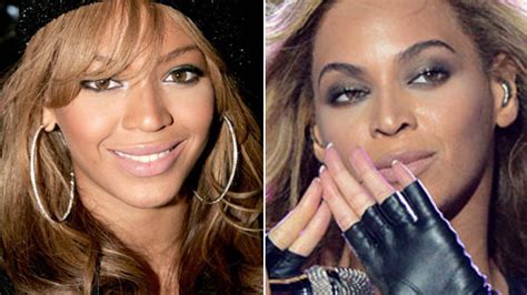 Beyonce Nose Job Rumors — Did She Go Under The Knife? Experts Weigh In ...