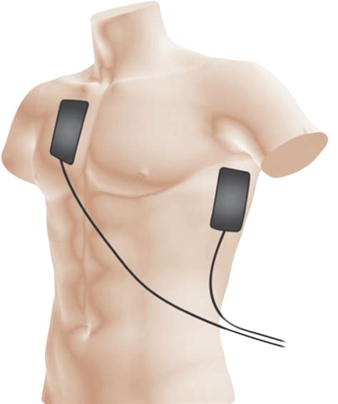 How to correctly place defibrillator pads – Tommaso Scquizzato, MD