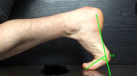 Why Is The Big Toe So Important For Runners? | Matthew Boyd Physio