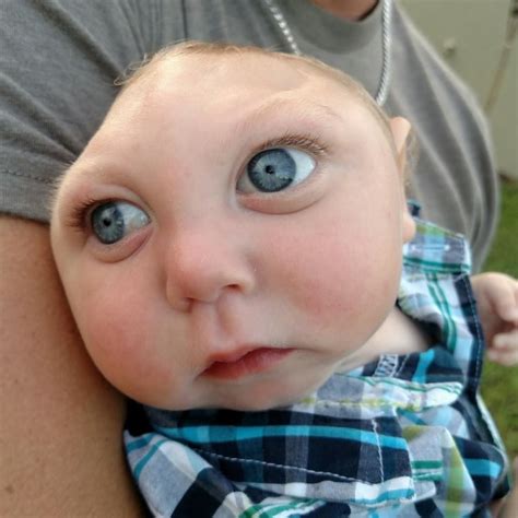 'Jaxon Strong:' Baby missing part of brain thrives despite odds