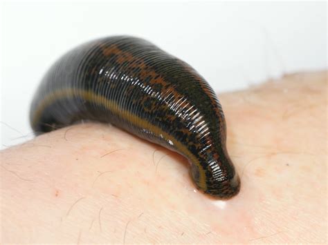 Leech Therapy: All You Need To Know About This Ayurvedic, 48% OFF