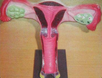 Uterus 3d Anatomy at Best Price in Mumbai, Maharashtra | Val Creation