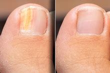 Toe Free Stock Photo - Public Domain Pictures