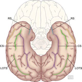 Sulcus Collateralis