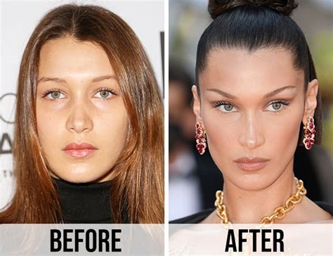 Bella Hadid Before And After Pictures: The Model's And Social Media Star's Beauty Progression