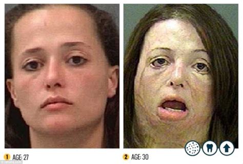 faces of meth