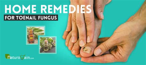 9 Best Home Remedies for Toenail Fungus to Prevent Infection