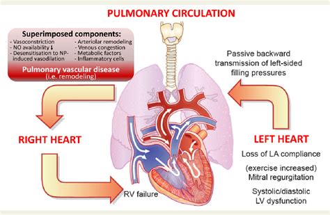 Figure 1 from Left ventricular heart failure and pulmonary hypertension ...