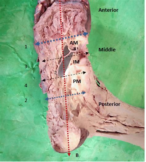 What is a Deep Plantar Arch? - Plantar People