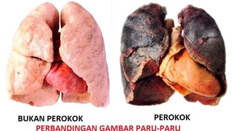 7 Cara Membersihkan Paru-paru Perokok dengan Cepat – Cianjur Ekspres