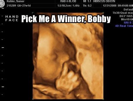 The 20 Funniest Ultrasound Pictures Ever