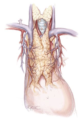 Thymoma | Dr Cheng He | Heart Lung Surgeon | Gold Coast - Heart & Lung Surgeons in Gold Coast