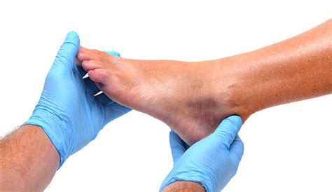 Foot Bruise, Causes, Treatment - Post Oak ER